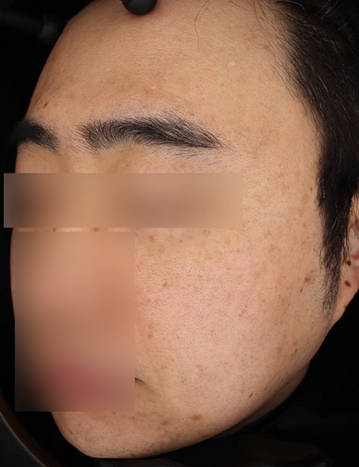 Before