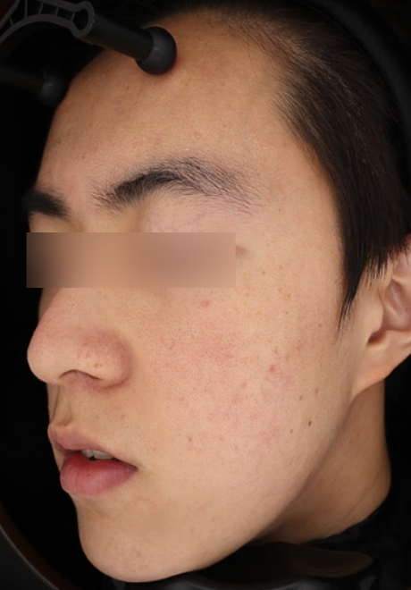 Before