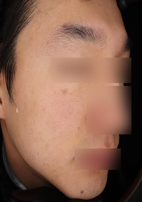 Before