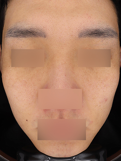 Before