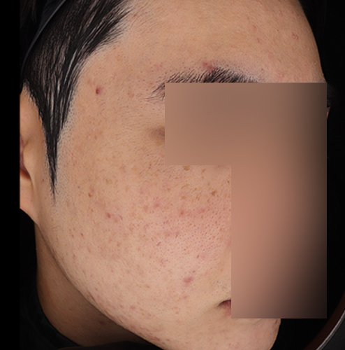 Before