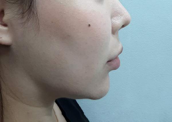 Before