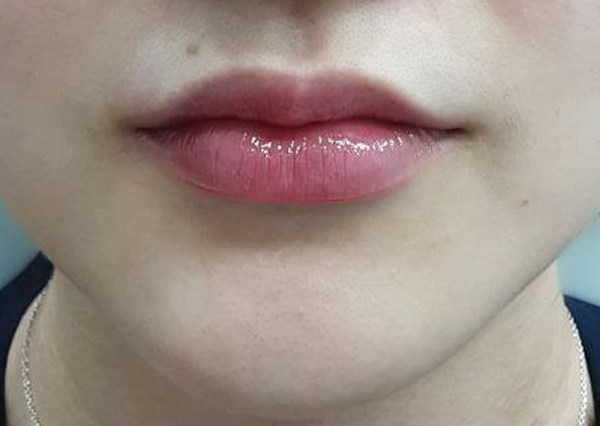 Before