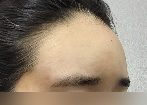 Before