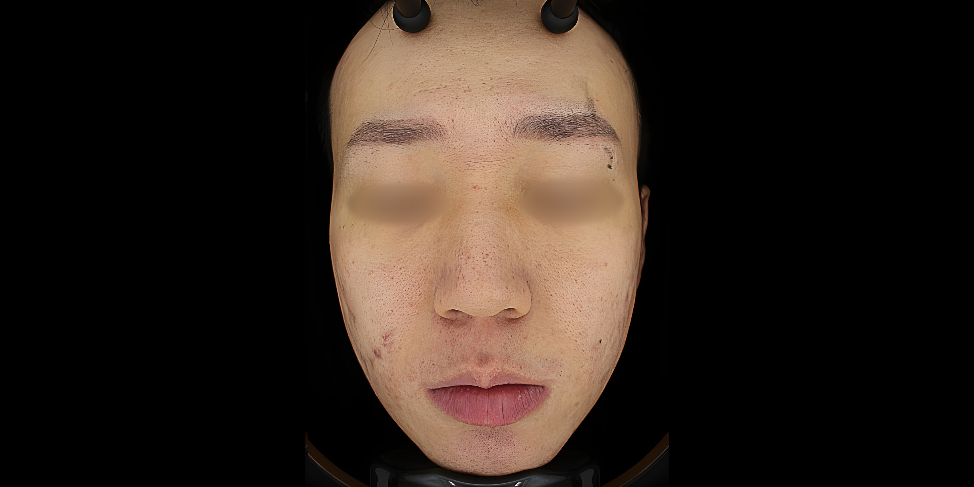 Before
