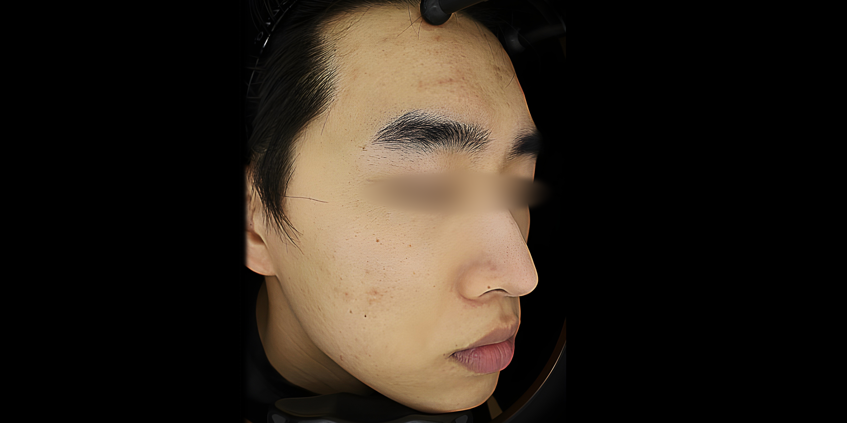 Before
