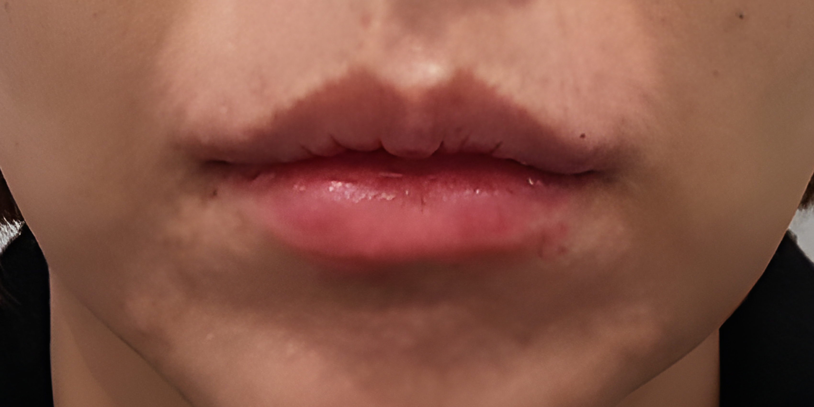 Before