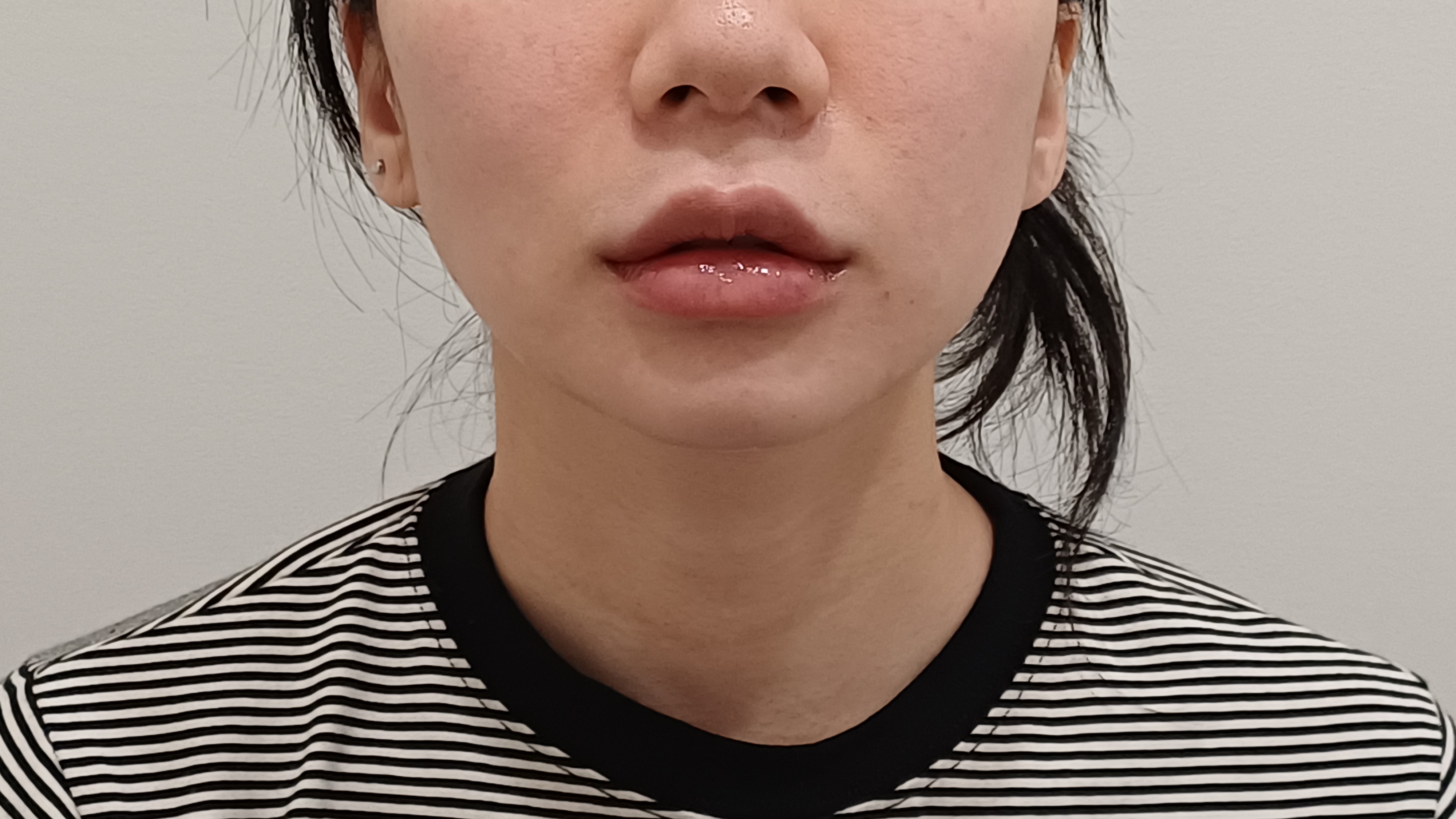 Before