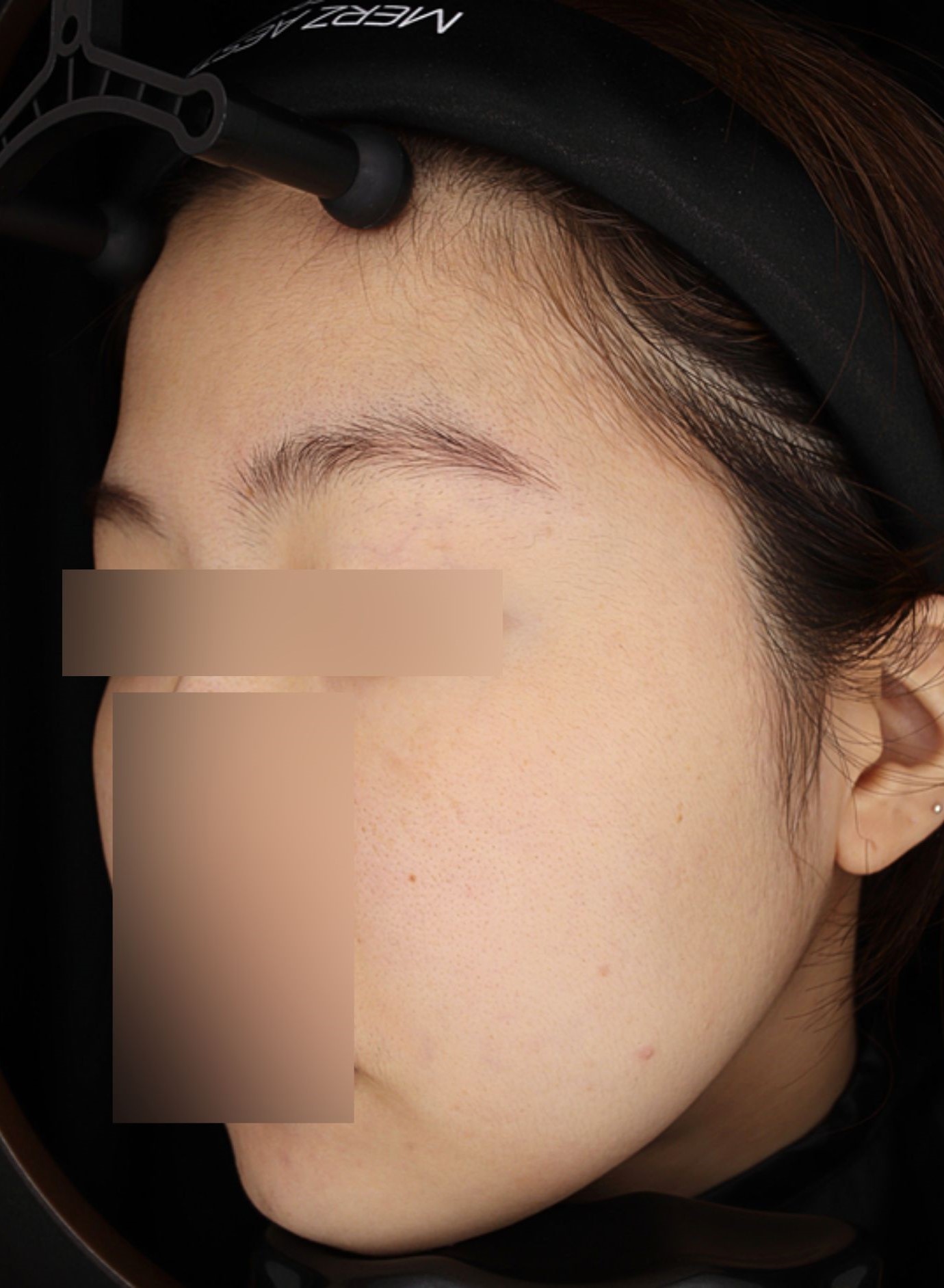 Before