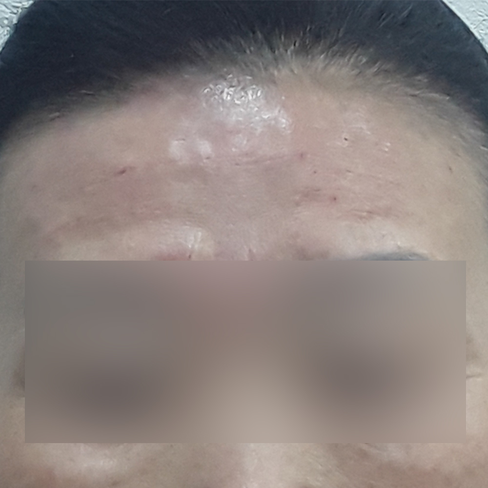 After