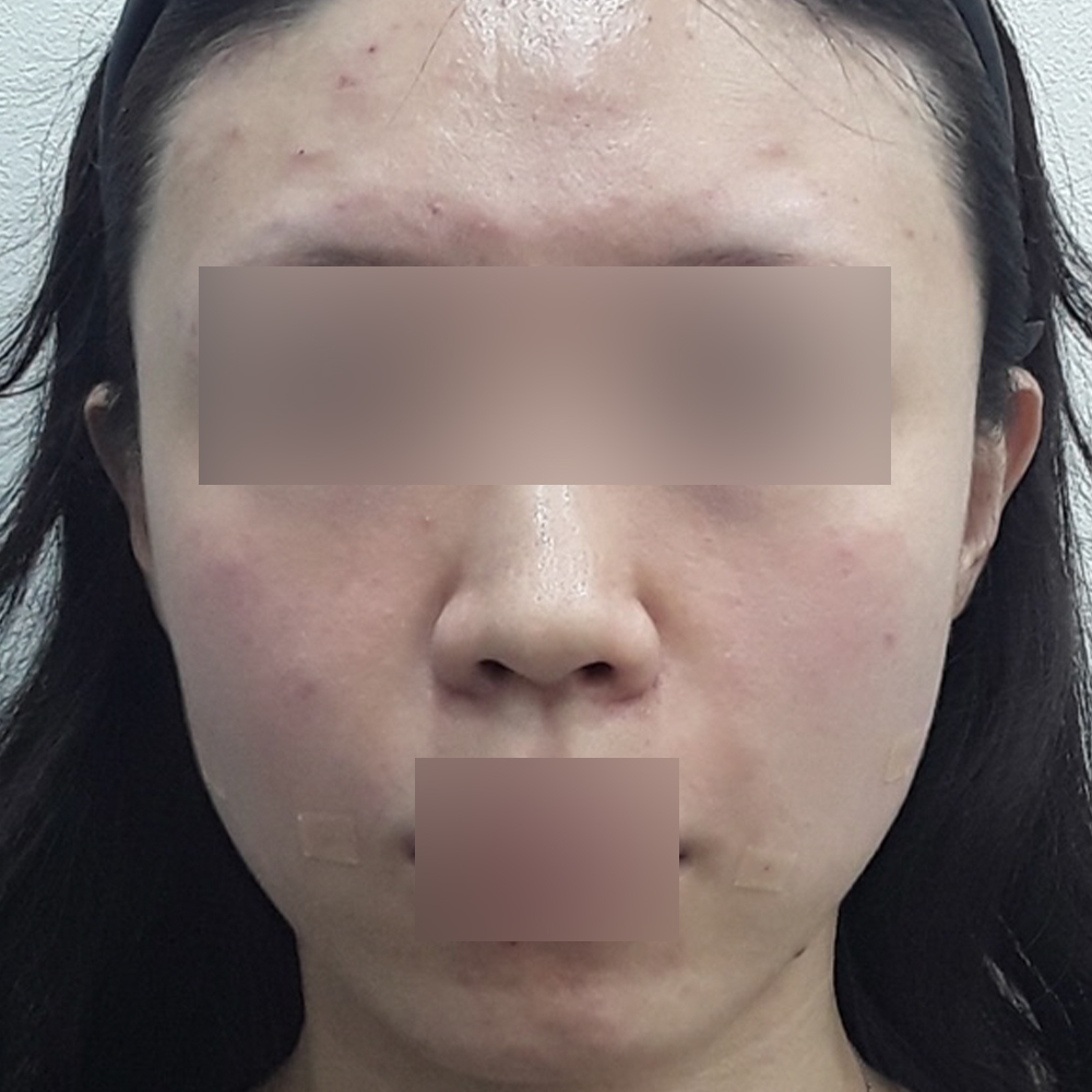 After