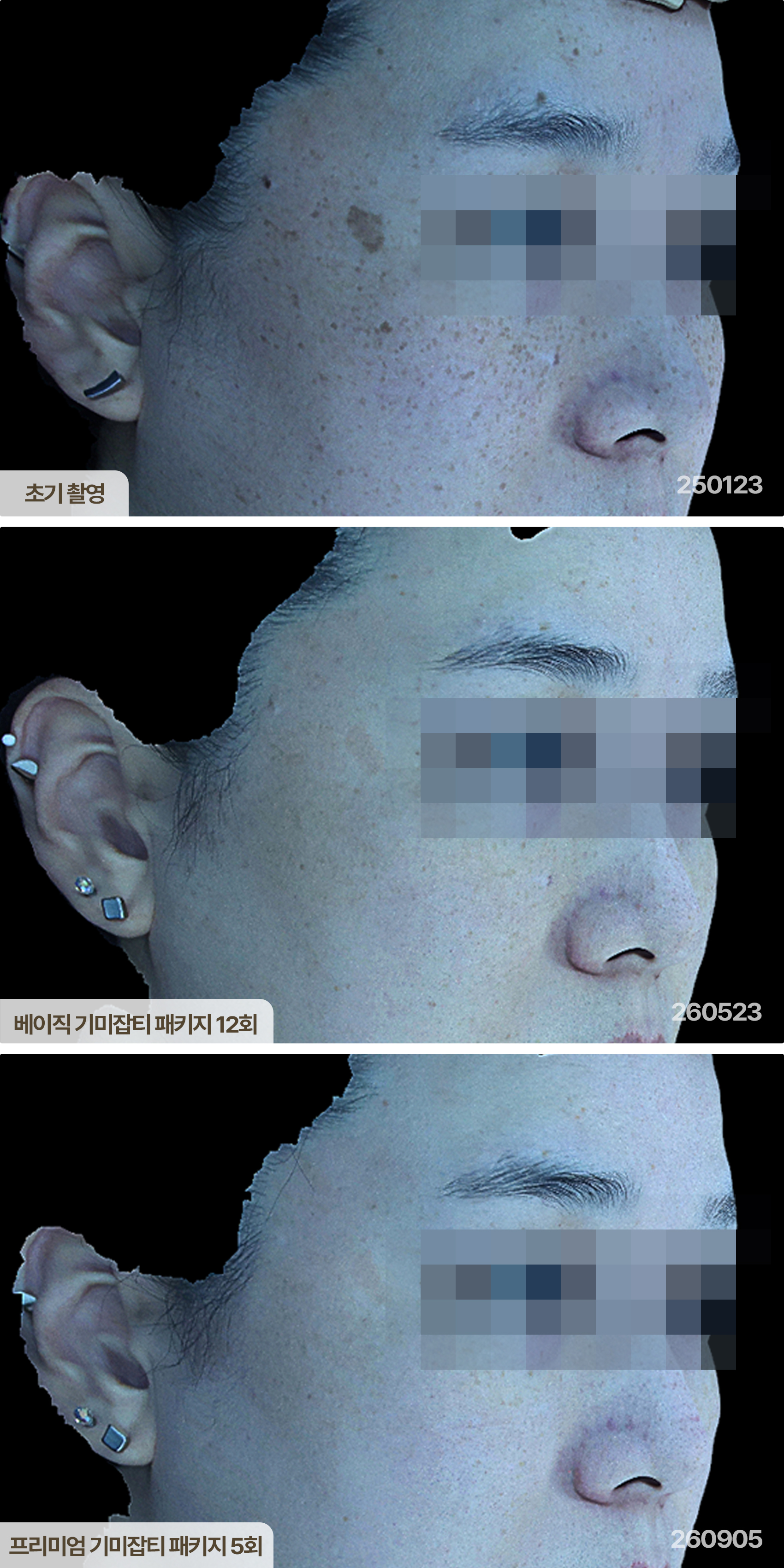 After