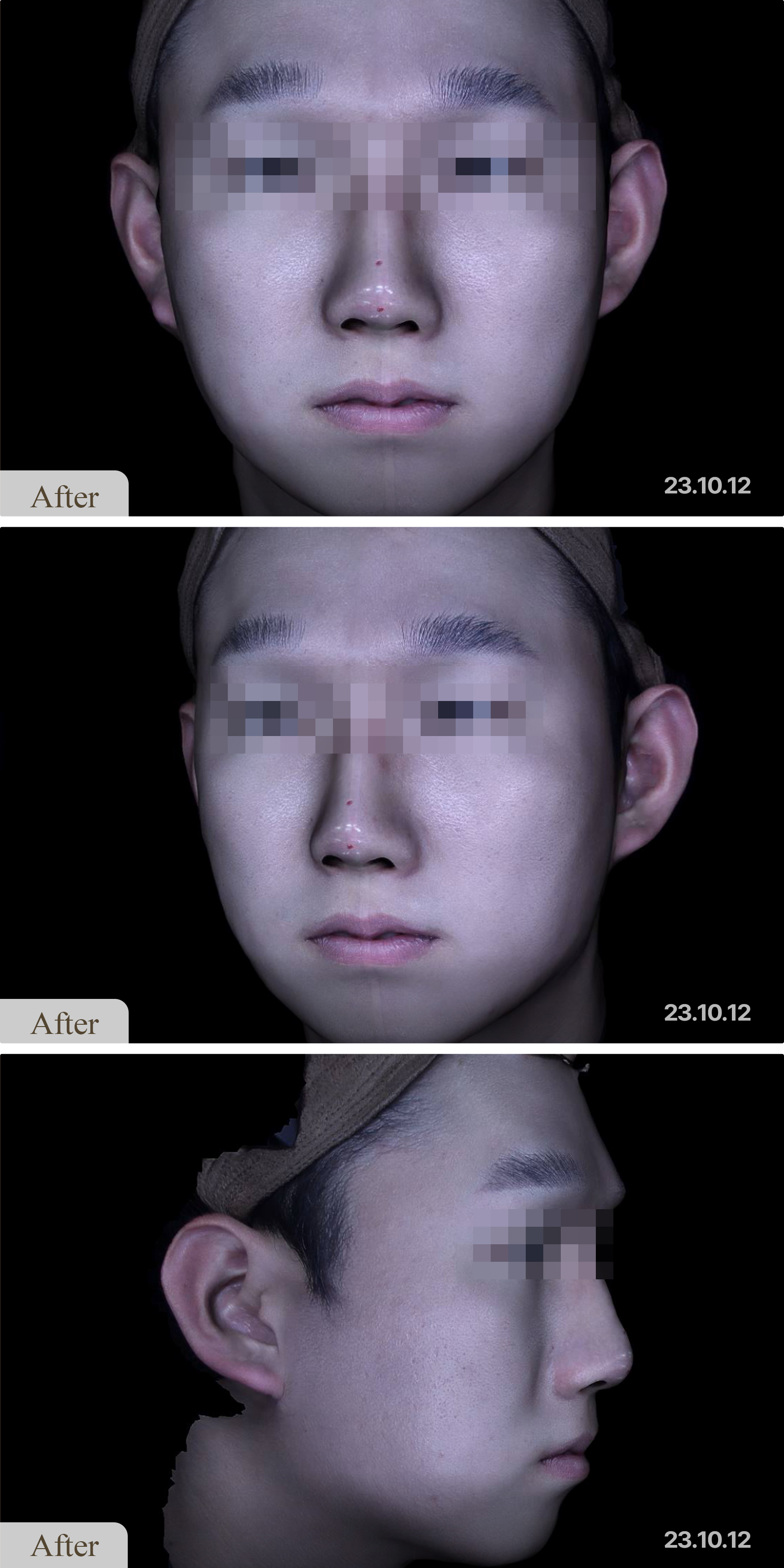 After