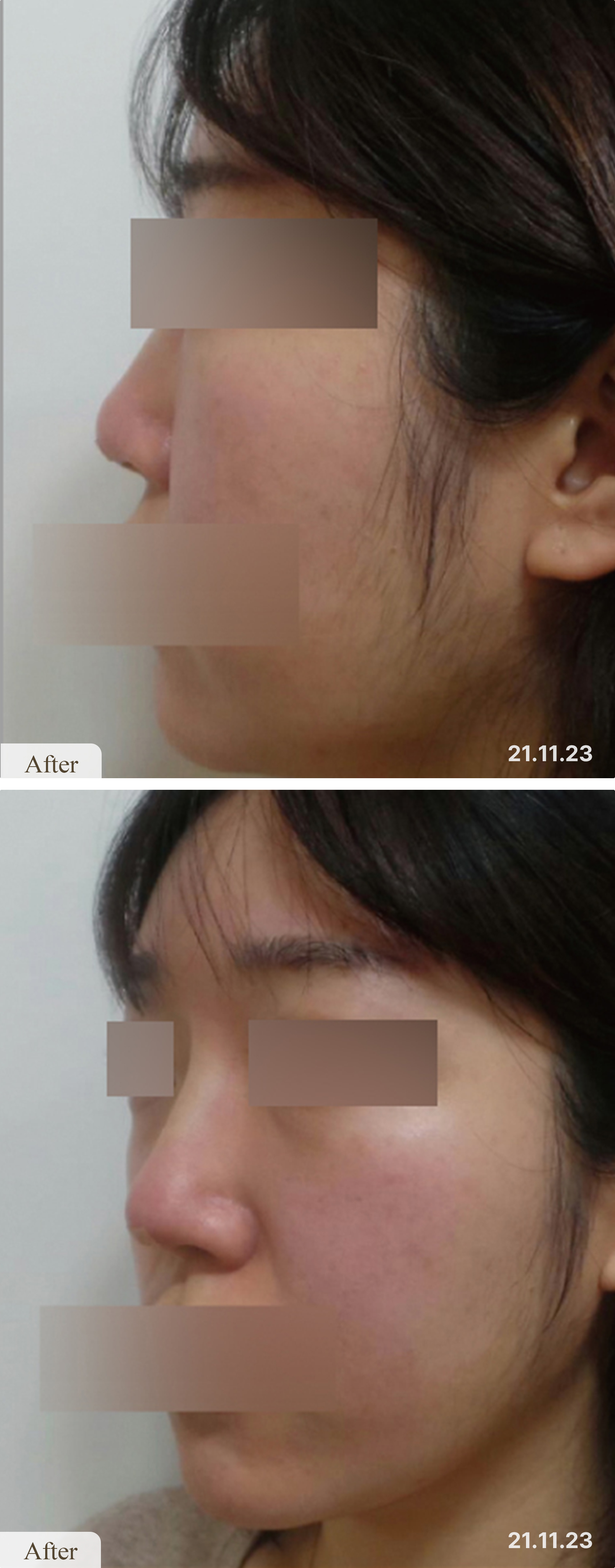 After