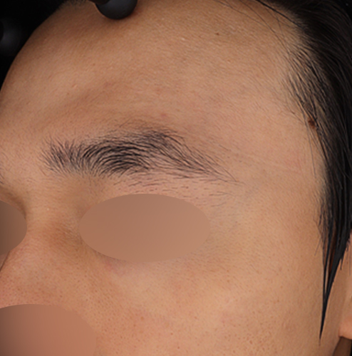 After