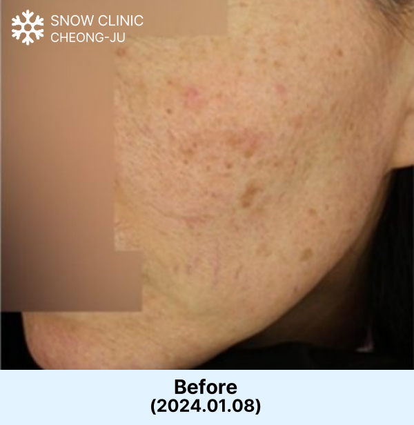 Before