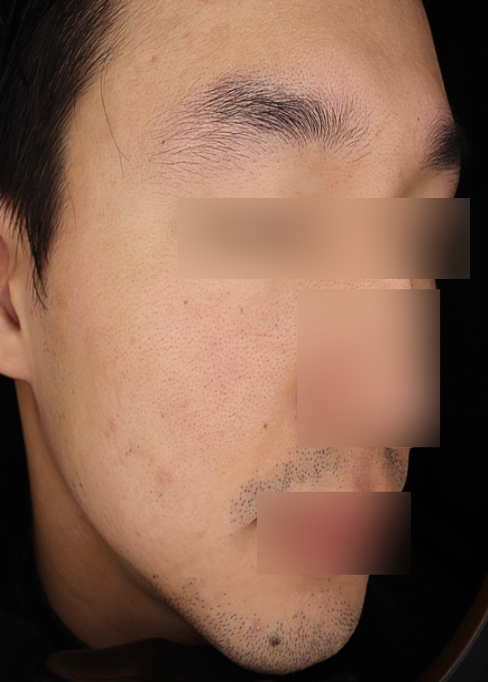 Before
