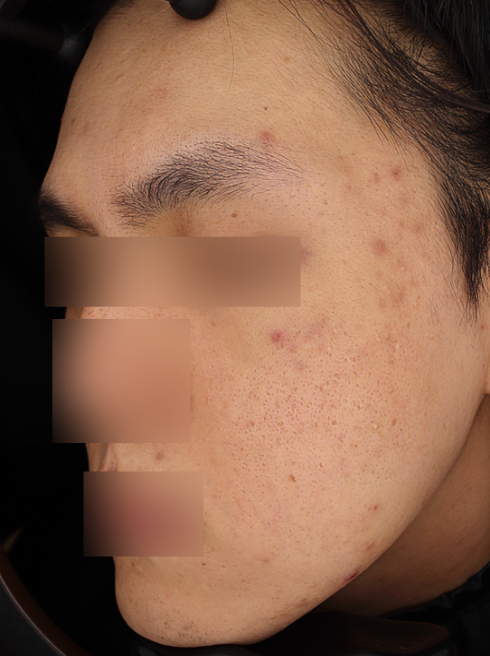Before