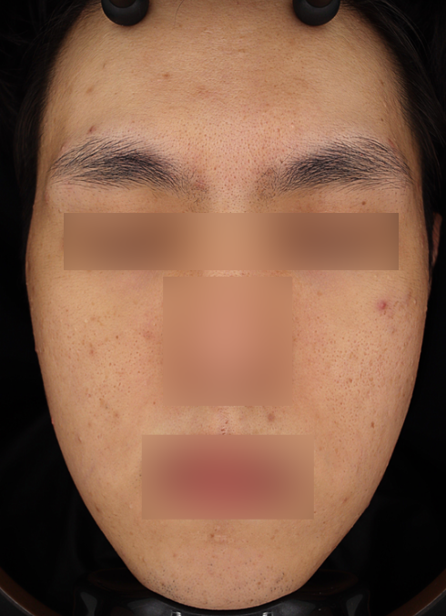 Before