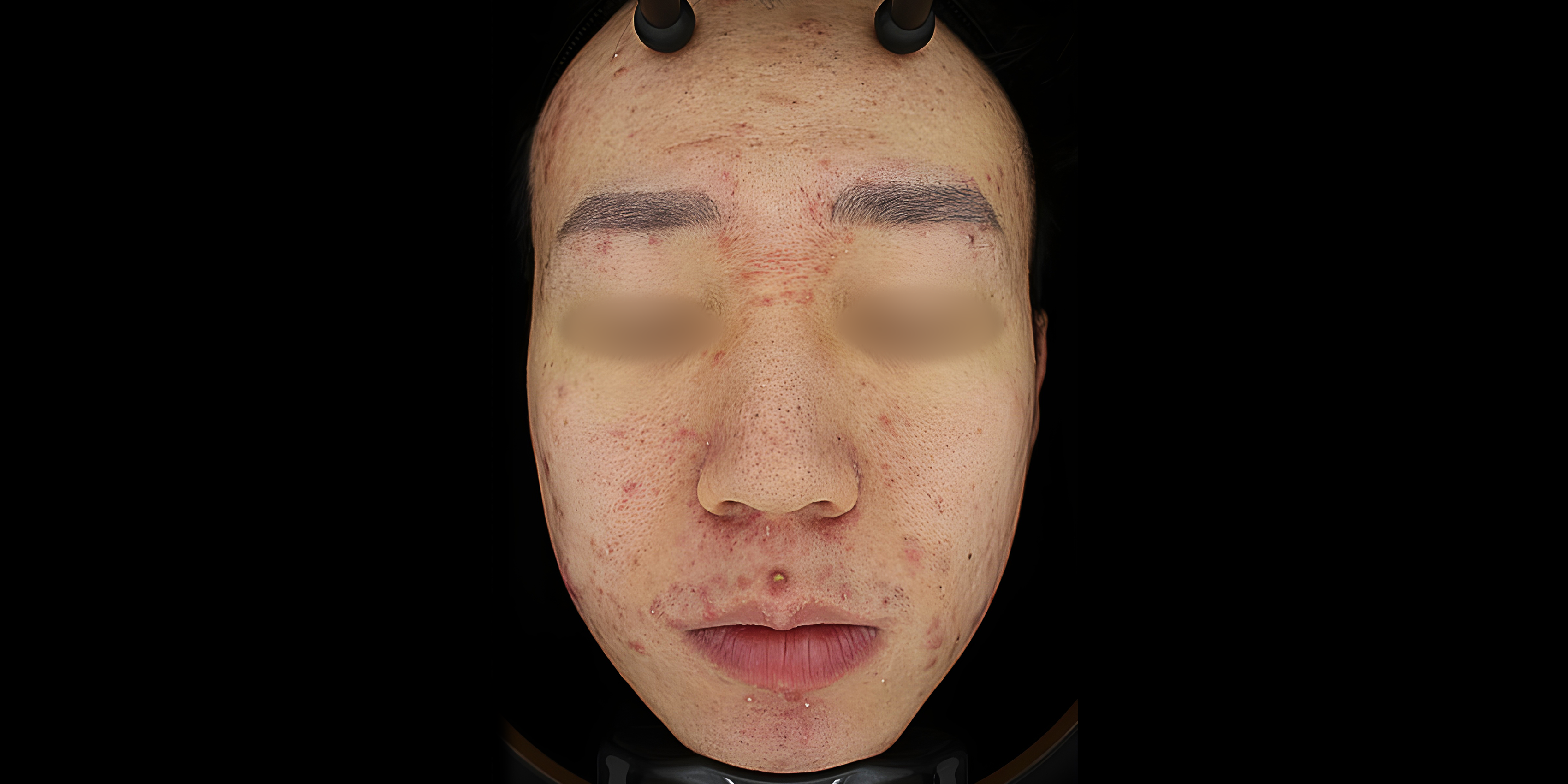 Before