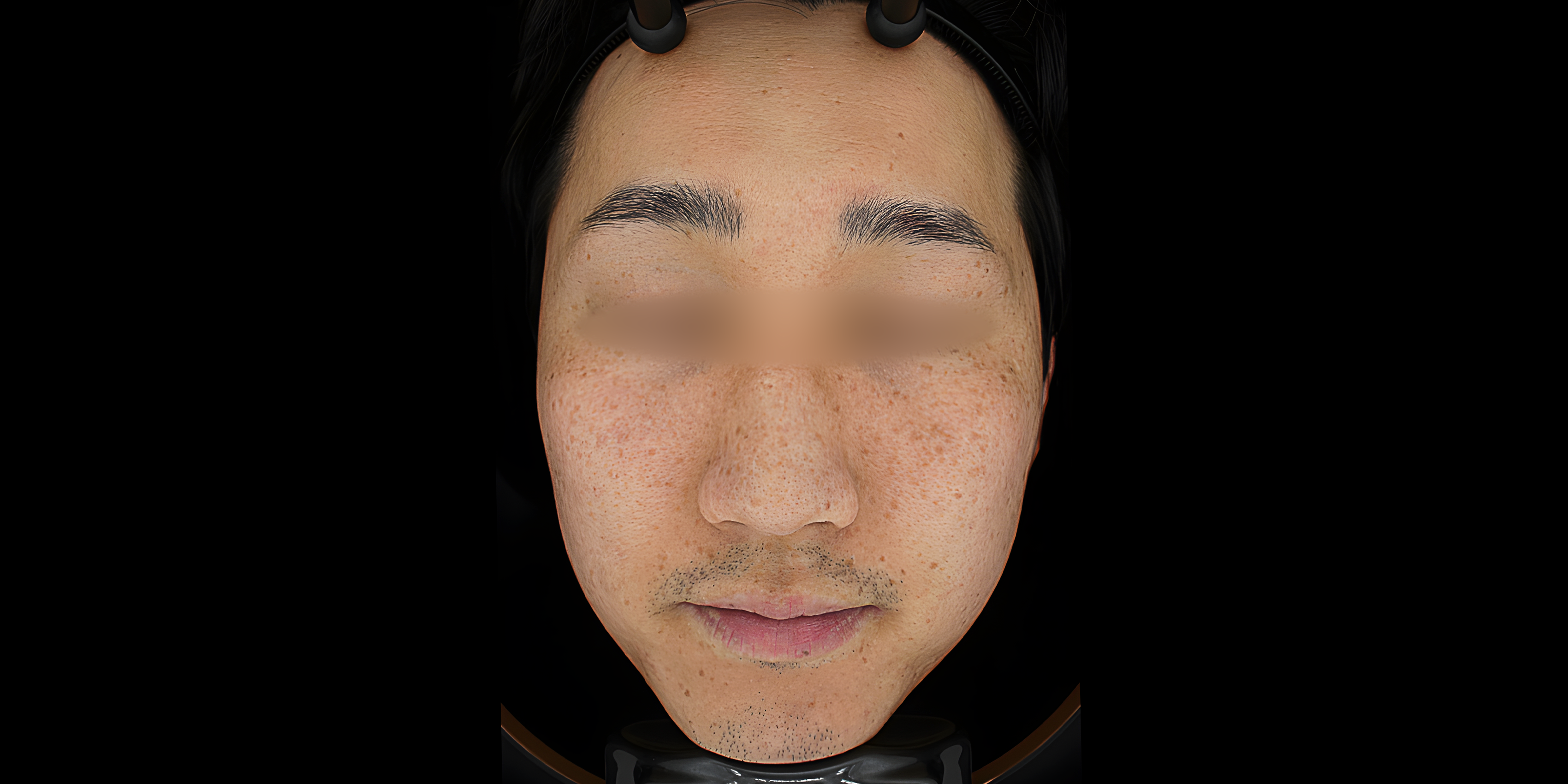 Before