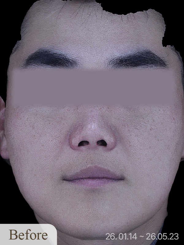 Before