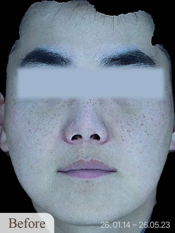 Before