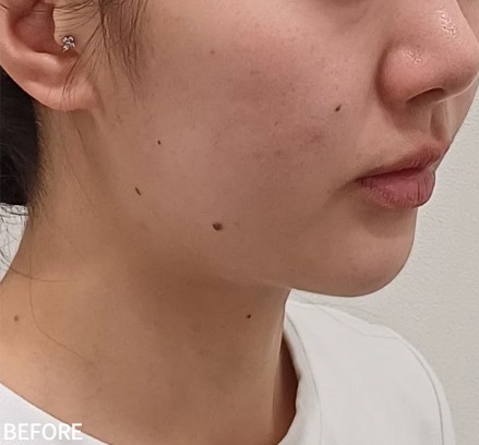 Before
