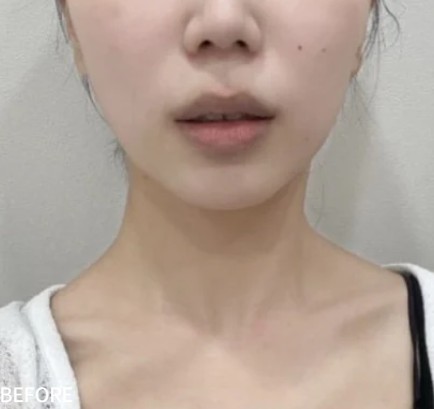 Before