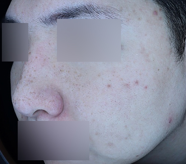Before