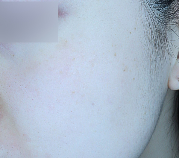 Before