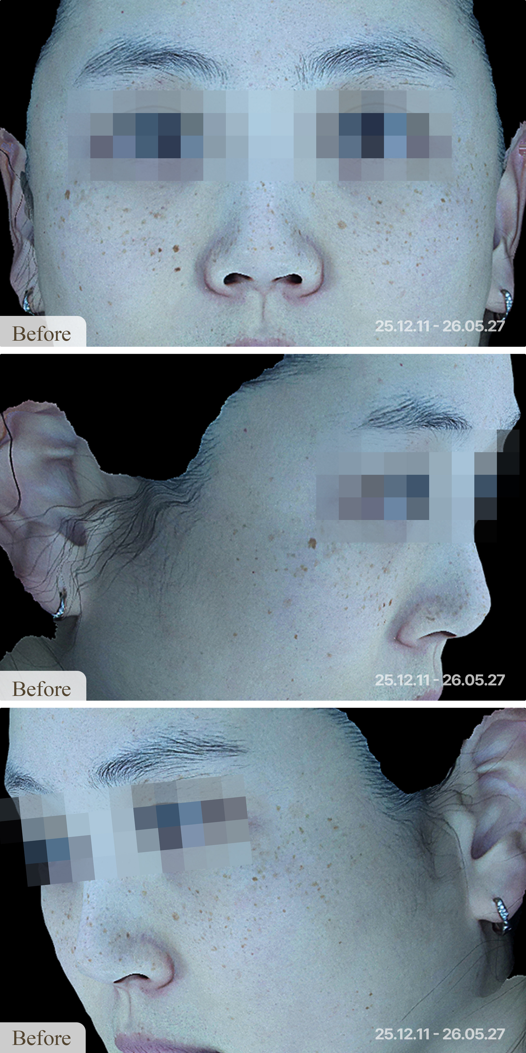 Before