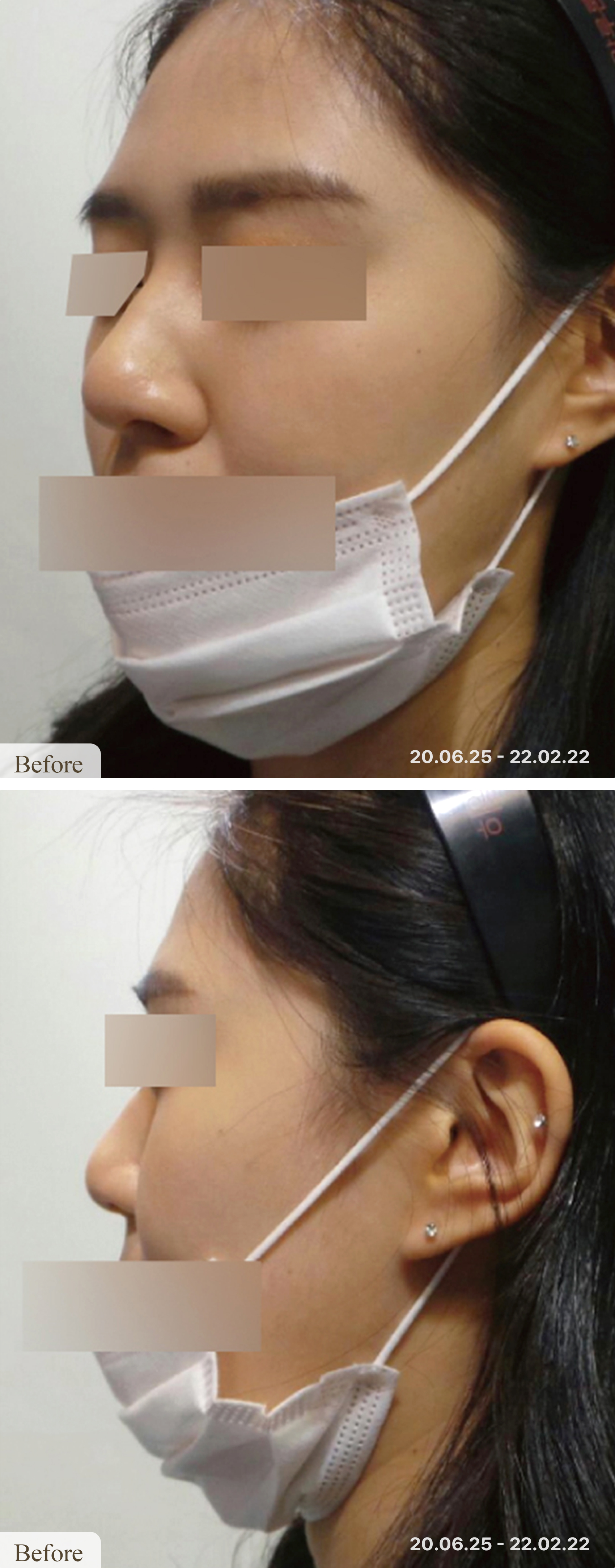 Before