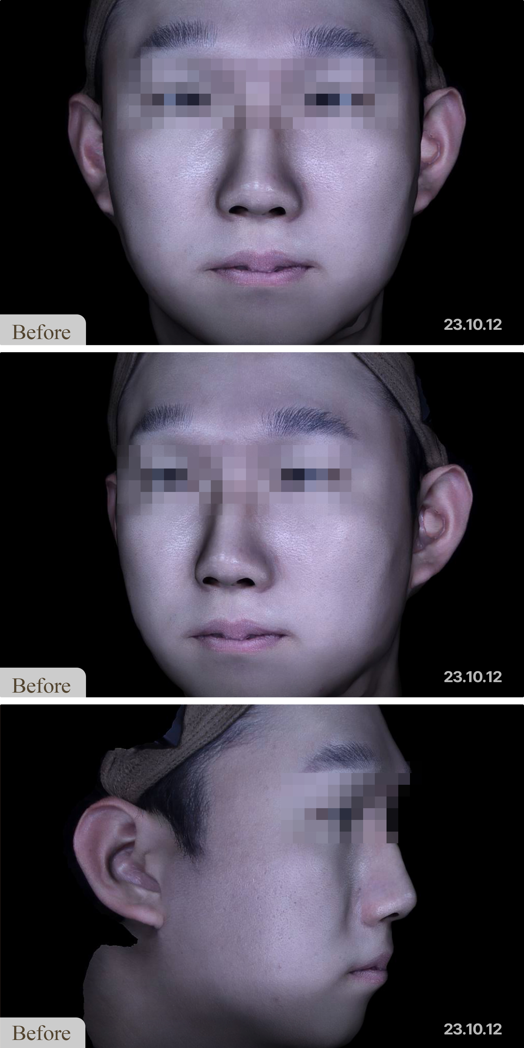 Before