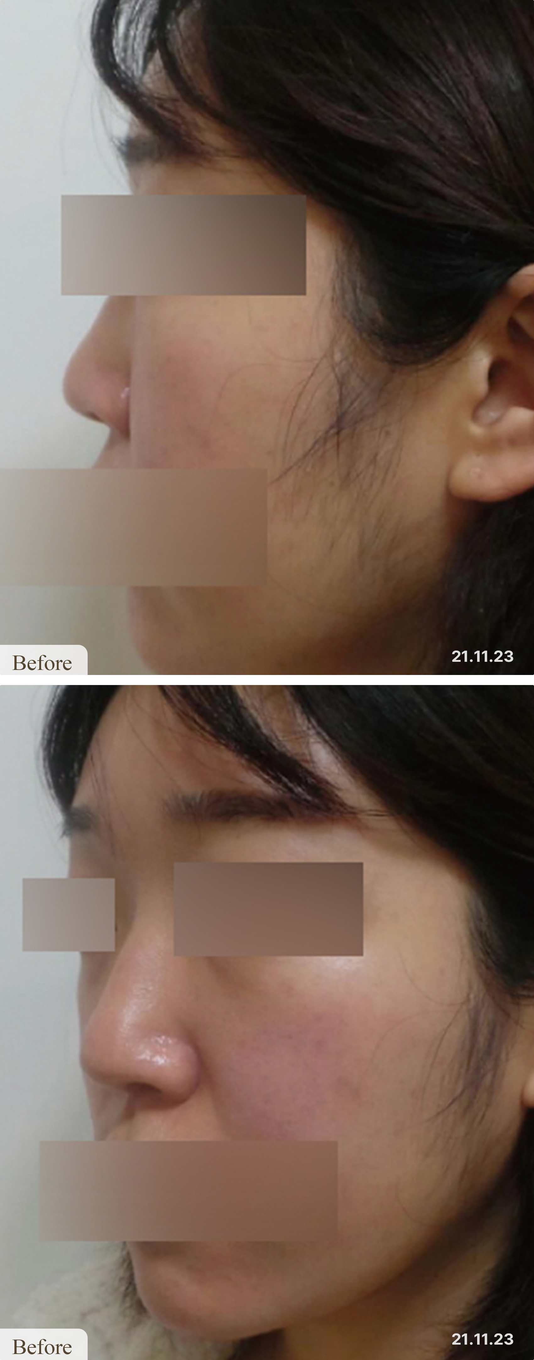 Before