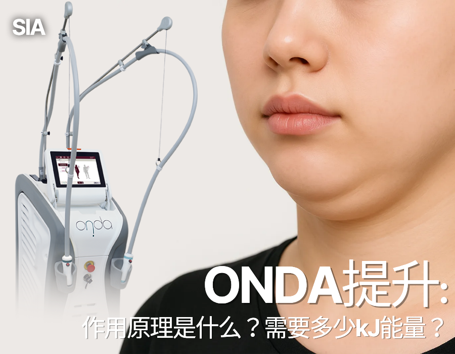 韩国Onda提升是什么？需要多少kJ能量？