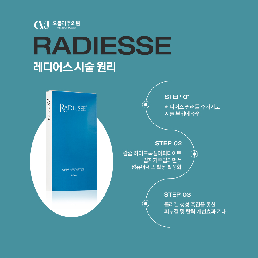 레디어스 원리