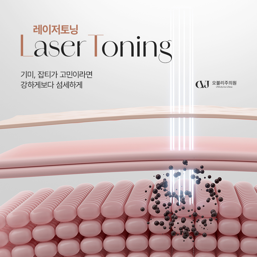 레이저토닝 기미 잡티 주근깨 피부톤 색소침착 치료