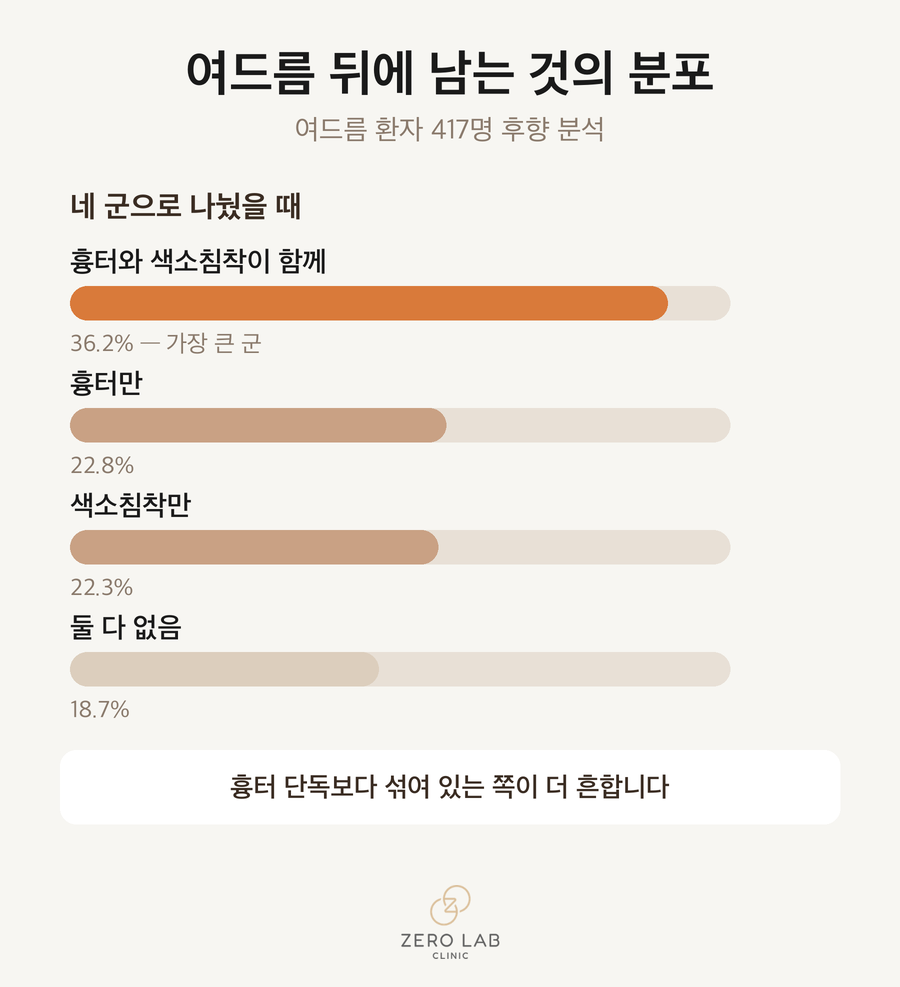 여드름 후 남는 것의 분포
