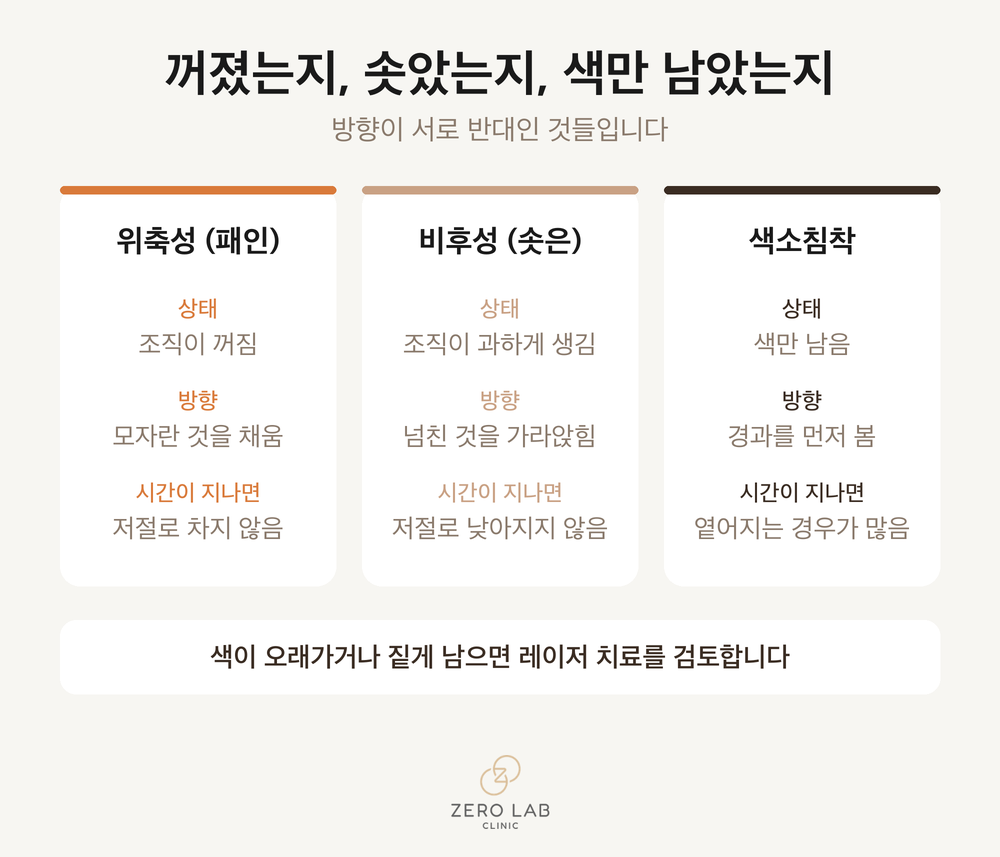 흉터 유형별 비교 카드