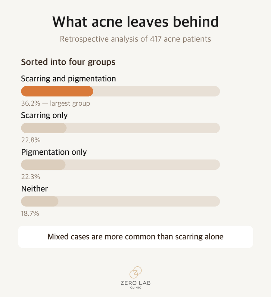 Distribution of what acne leaves behind