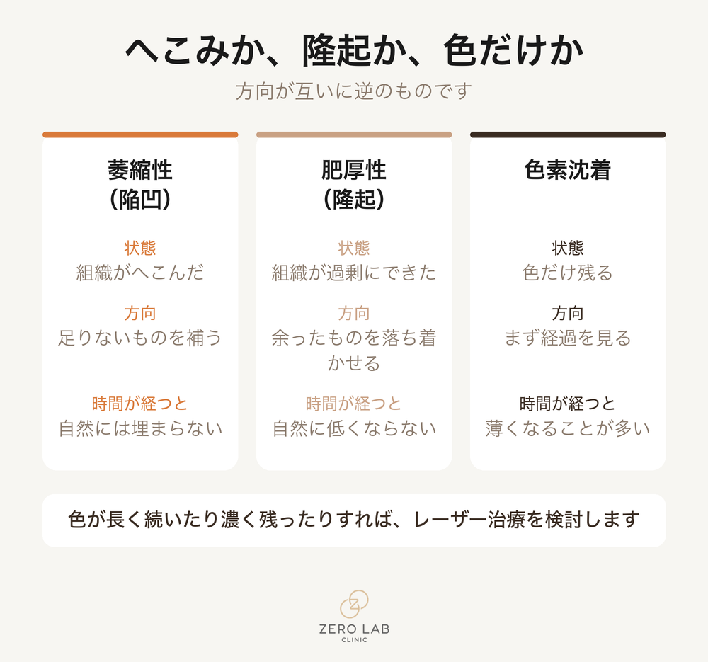 跡のタイプ別の比較カード