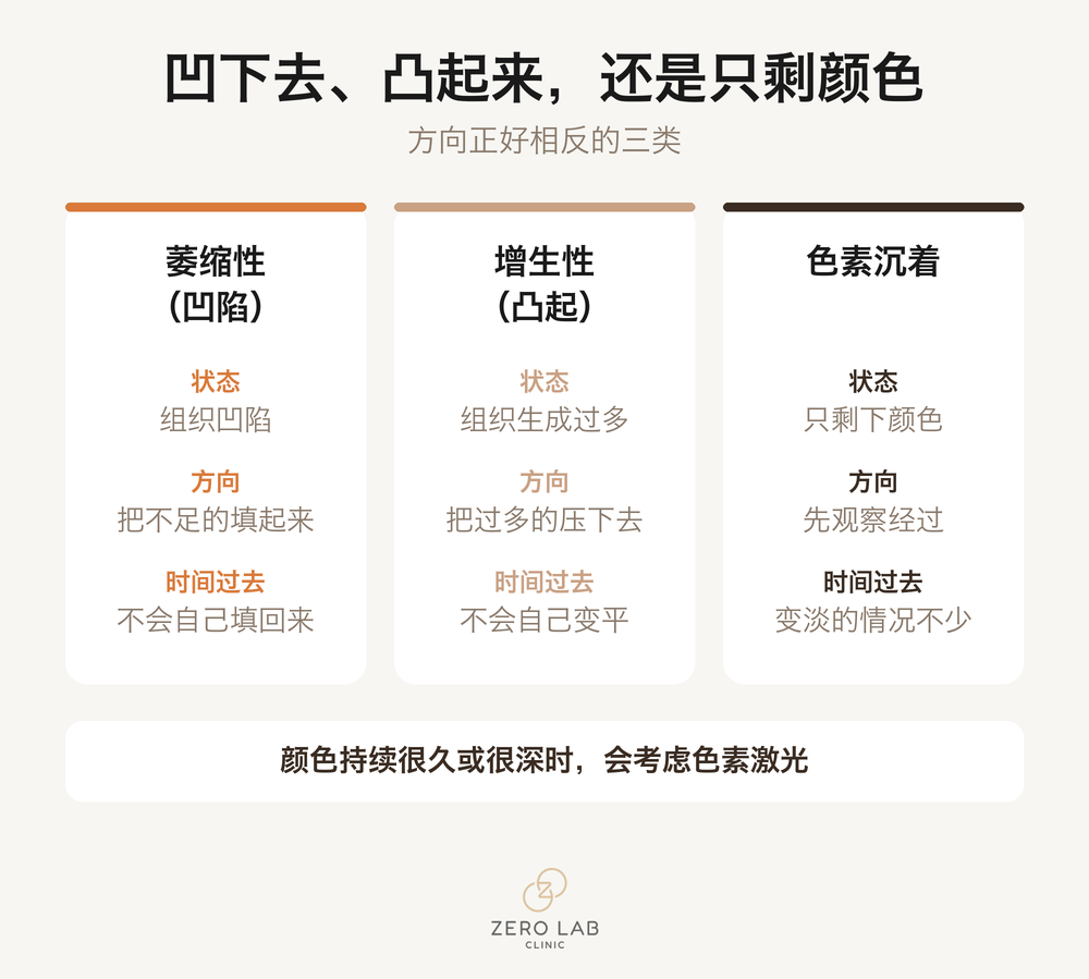 疤痕类型对比卡