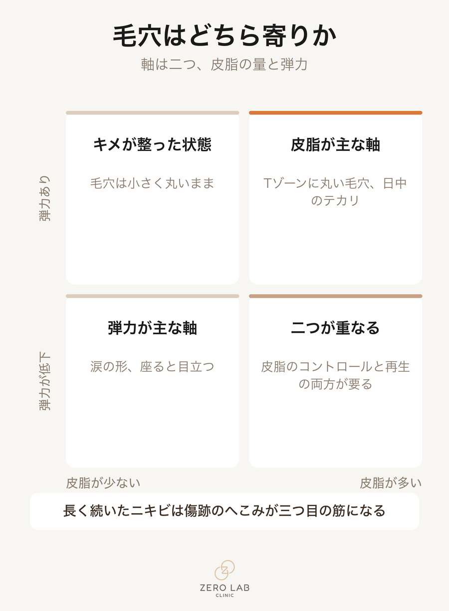 皮脂量と弾力の2×2マトリックス