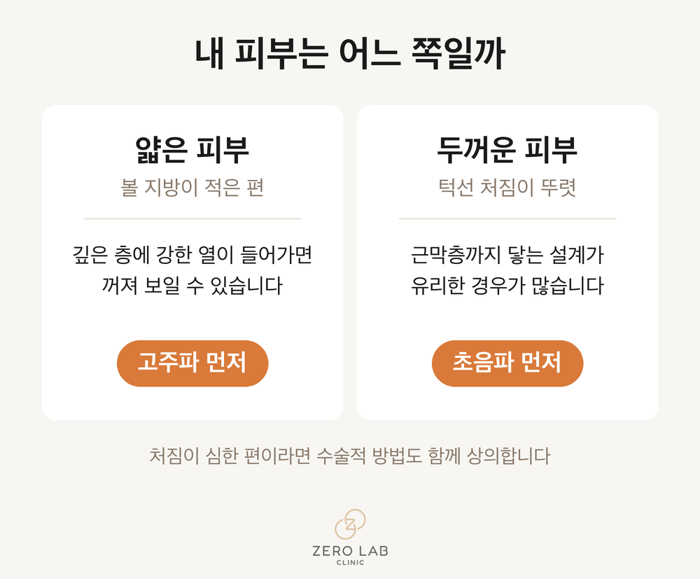 내 피부는 어느 쪽일까 인포그래픽