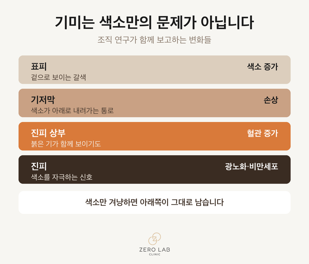 기미에서 관여하는 피부 층