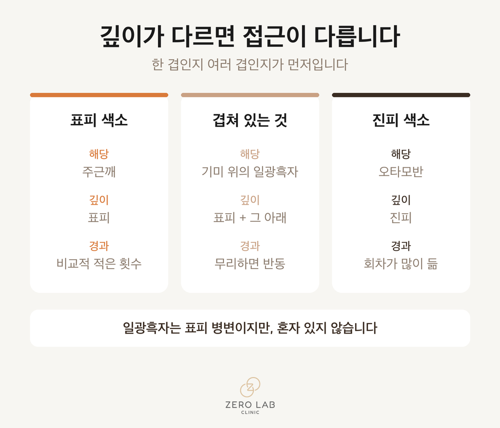 색소 유형별 비교 카드