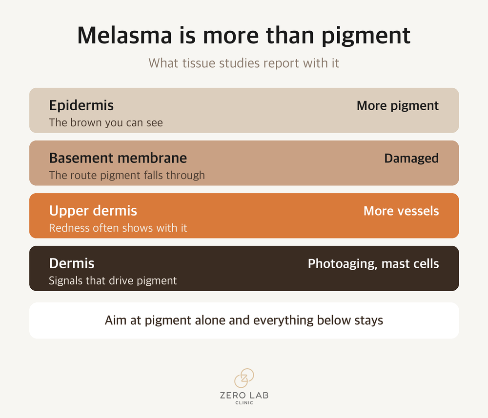 The skin layers involved in melasma