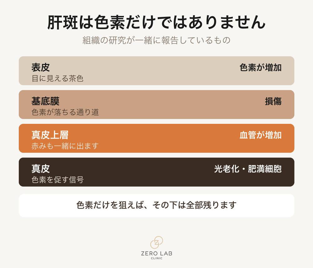 肝斑に関わる皮膚の層