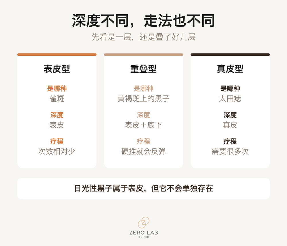 色素类型对比卡